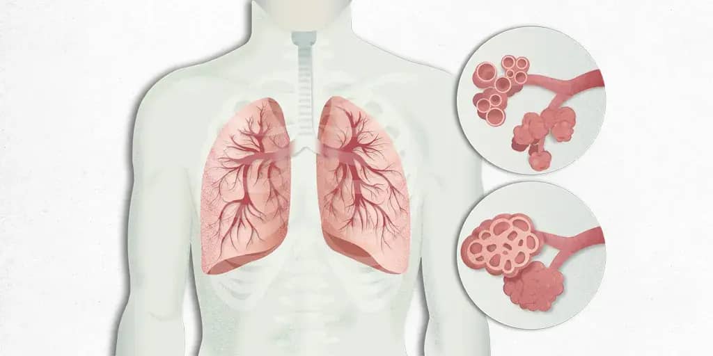 En Profundidad: La Fibrosis Pulmonar