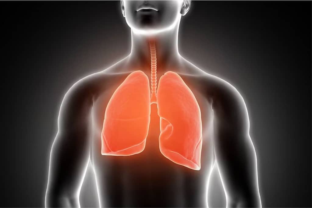 Fibrosis Pulmonar. ¿Qué es?