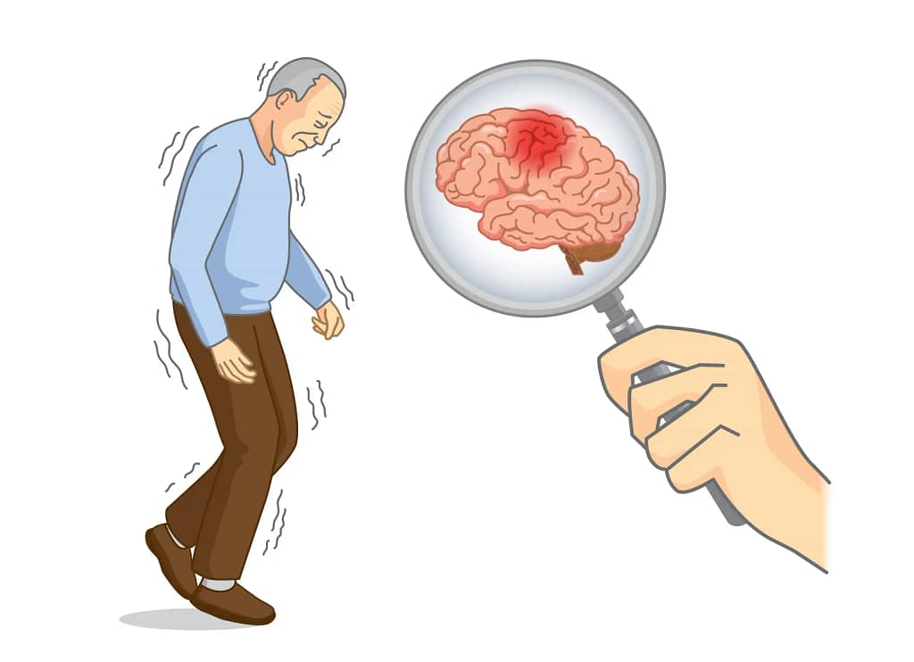 Enfermedad de Parkinson: Cómo Identificar, Tratar y Afrontar sus Desafíos