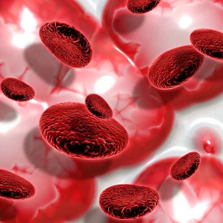 ¿Por Qué Subdiagnosticamos la Anemia Falciforme?