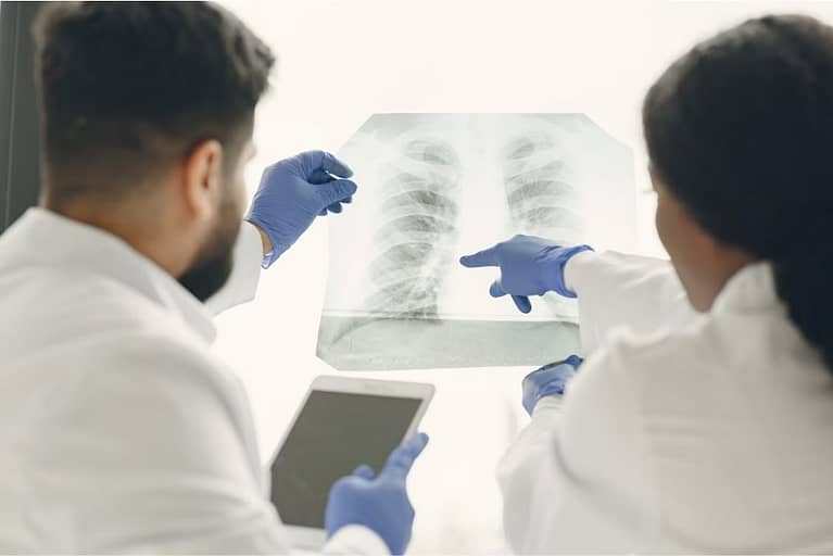 Qué es y cómo se trata la Fibrosis pulmonar