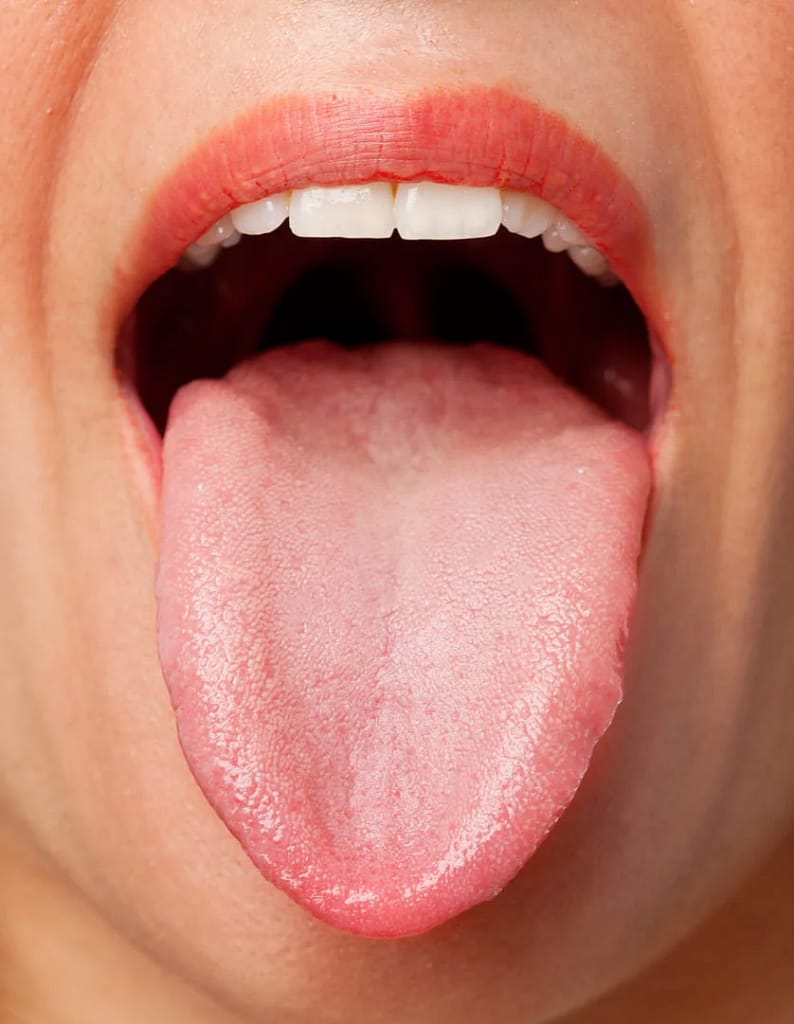interpretando la apariencia de tu lengua y su significado