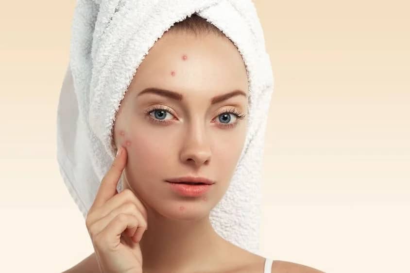 Diferencias entre foliculitis y acné