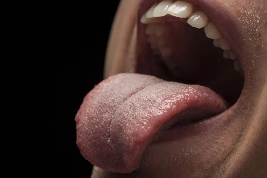 La apariencia de tu lengua